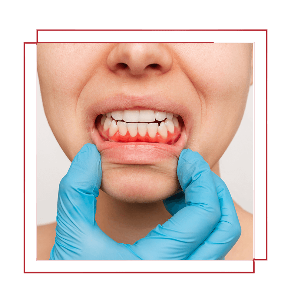 close up of patient having their gum examined