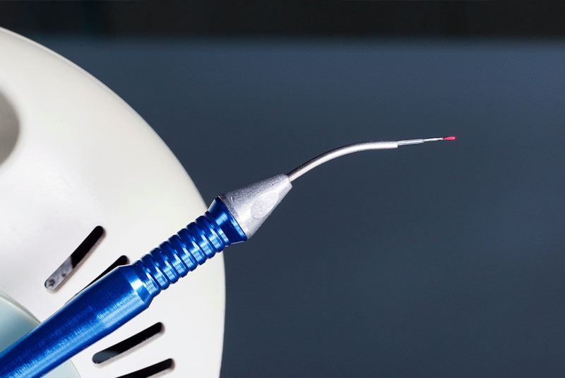 lanap protocol laser device up close