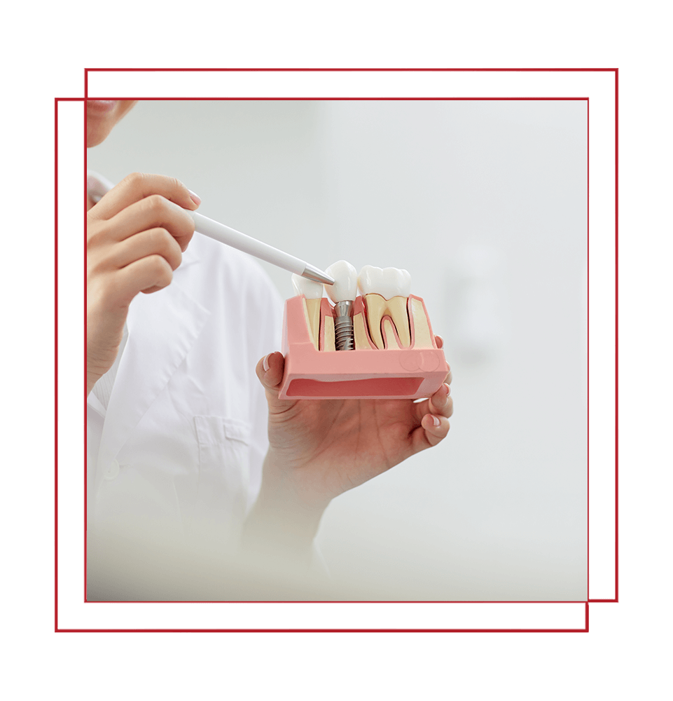 close up of a dental implant model